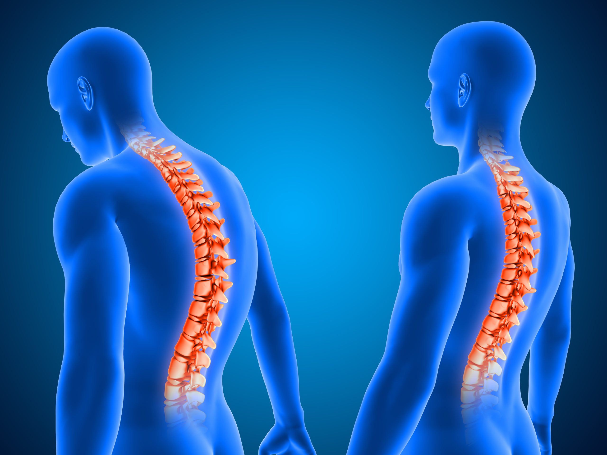 Chiropractors Help With Posture